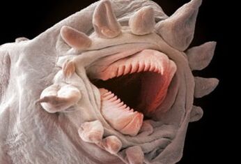 insan vücudunda hangi solucanlar yaşayabilir